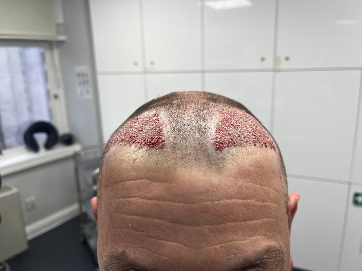 Hair Growth Centre — Dr.Visor photo 5