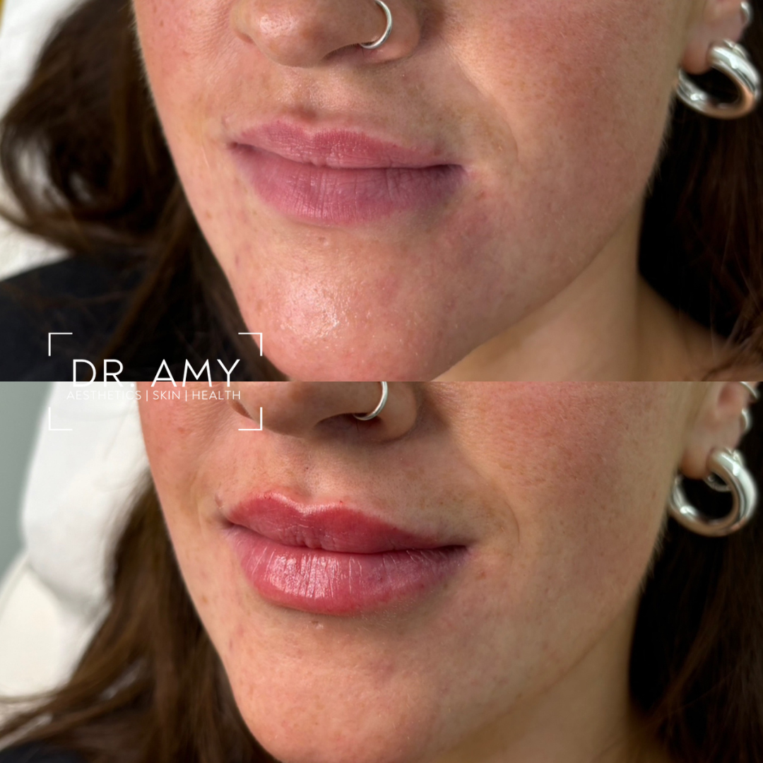 Dr Amy Aesthetics — Aesthetic Surgery Clinic in Belfast