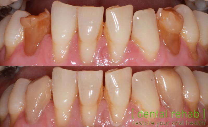 Newcastle Dental Implant Centre | Newcastle Advanced Dentistry — photo 3