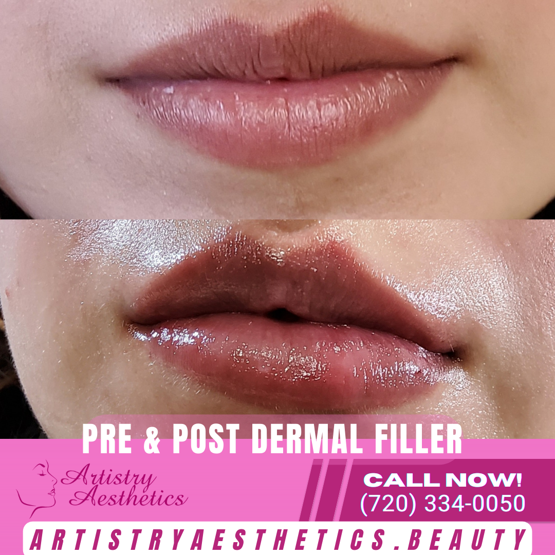 Artistry Aesthetics | Aesthetic Surgery | Thornton, CO