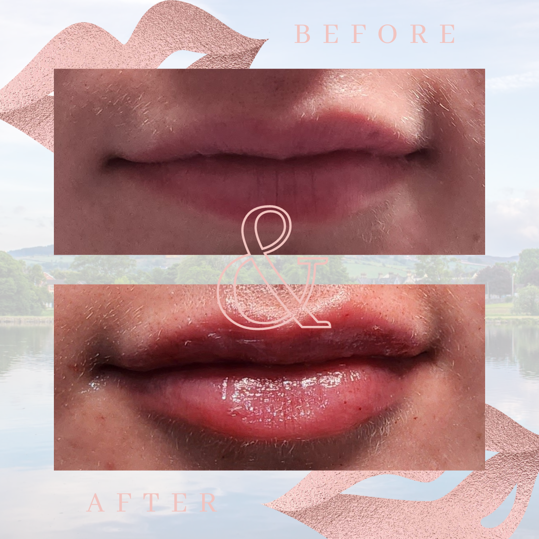 Lakeview Aesthetics — Aesthetic Surgery Clinic in Newry