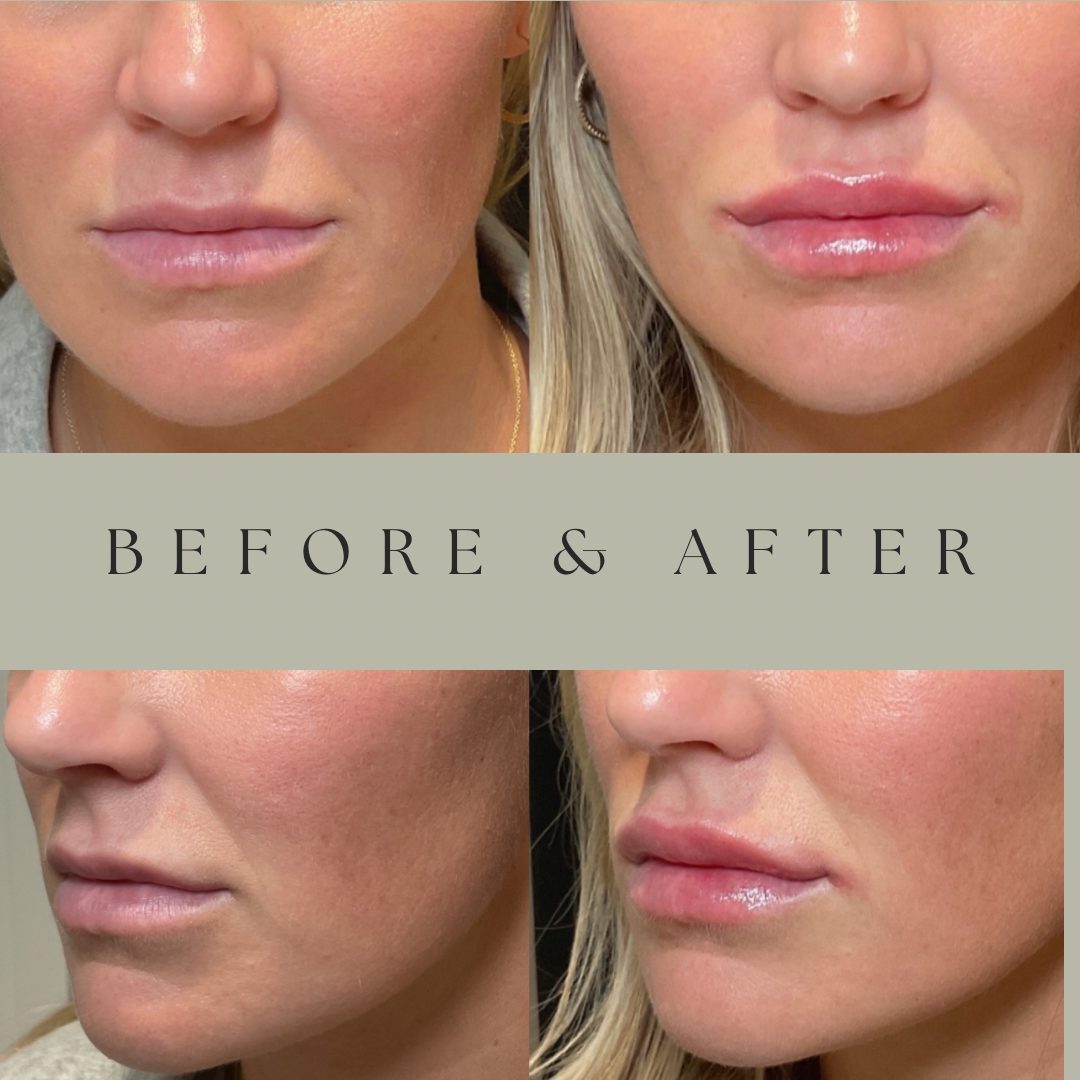 Aesthetics | Hair Transplant | Hurstbourne, KY