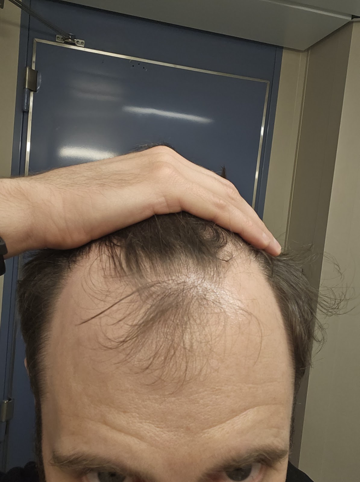 British Hair Clinic — photo 4