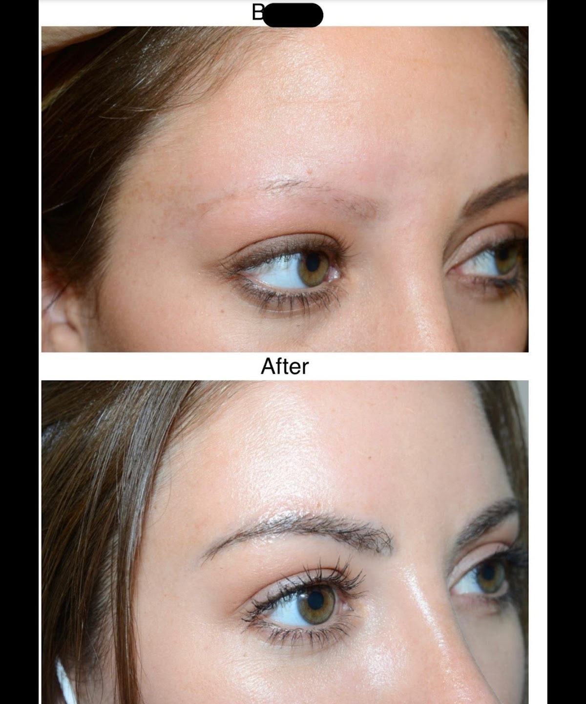 Harley street Hair transplants clinics Newcastle — photo 4