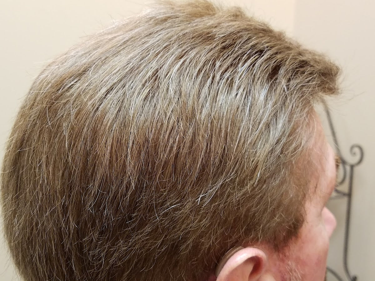 Distinguished Gentleman - DG Hair Solutions | Hair Transplant | Lee's Summit, MO