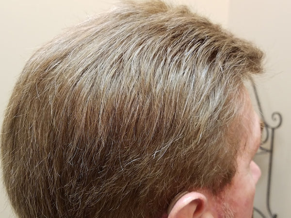 Distinguished Gentleman - DG Hair Solutions | Hair Transplant | Lee's Summit, MO