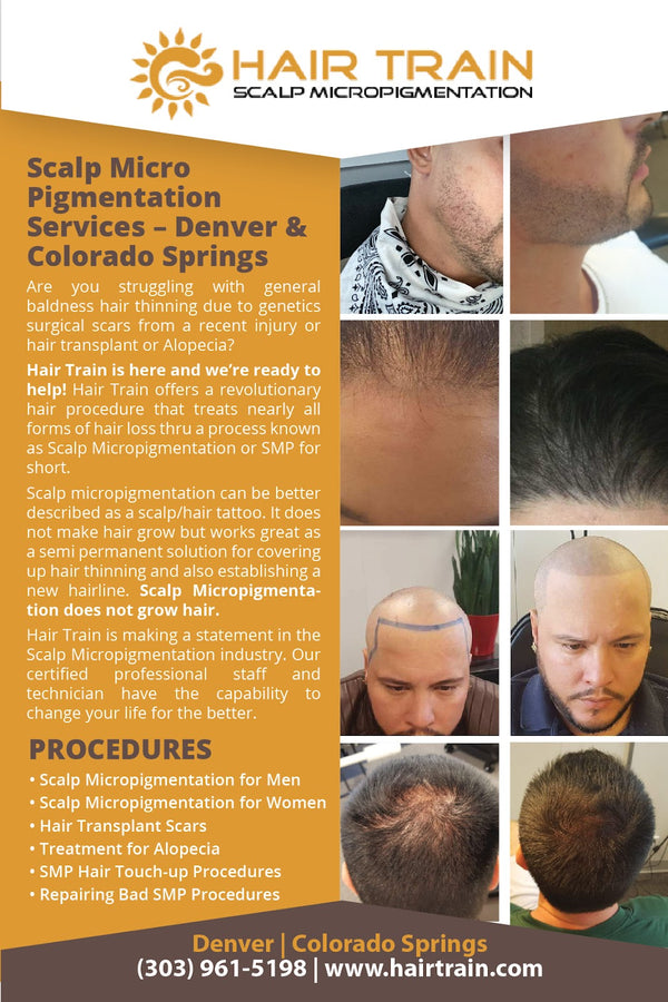 Hair Train Scalp Micropigmentation | Hair Transplant | Colorado Springs, CO