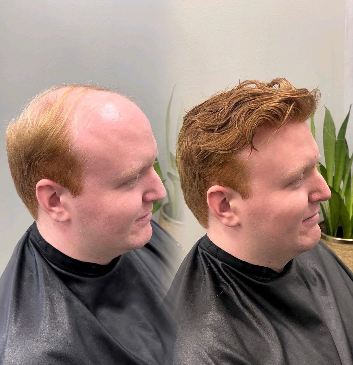 Hair Systems by Sam - Las Vegas | Hair Transplant | Henderson, NV