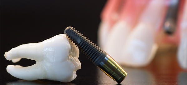 Sentrum Tannlegesenter | Dental | 0188 Oslo