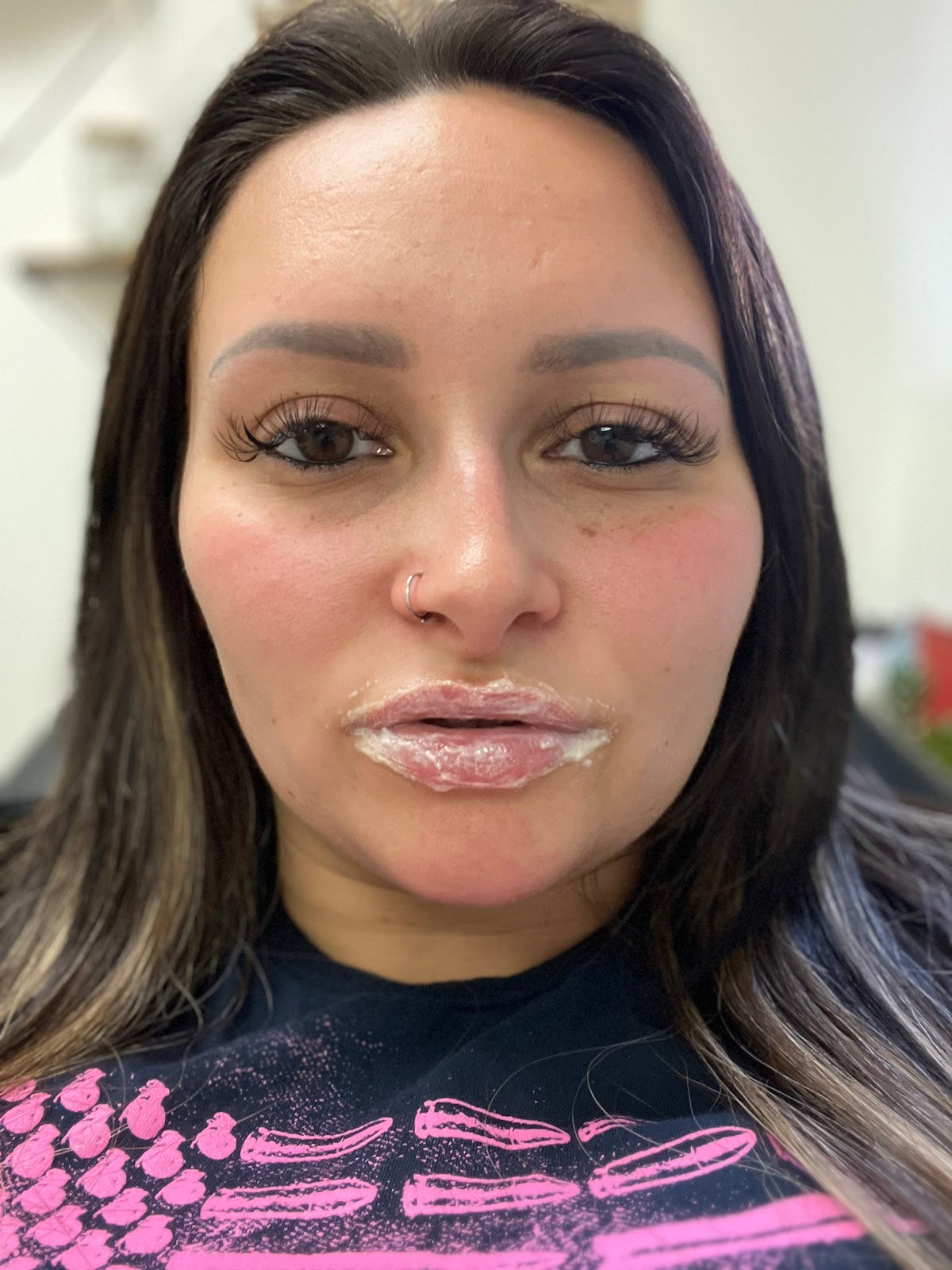 Skin Aesthetics LLC | Aesthetic Surgery | St Johnsbury, VT