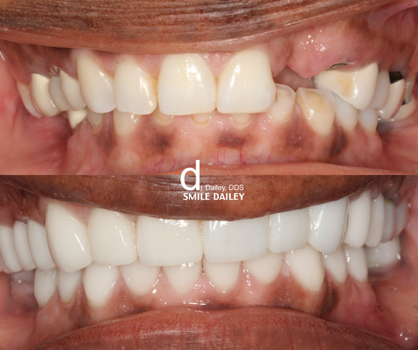Smile Dailey General and Cosmetic Dentistry | Dental | Little Rock, AR
