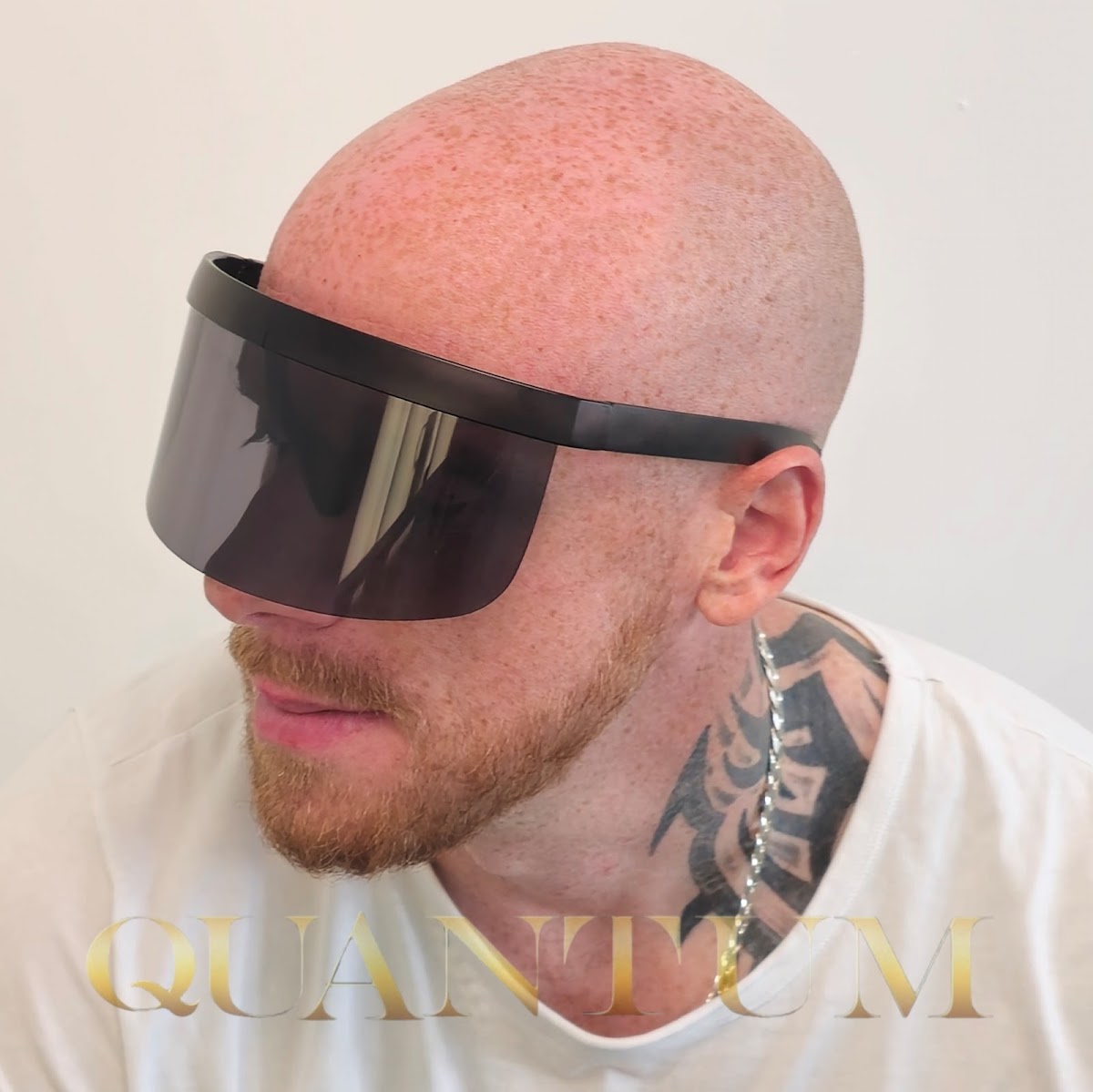 Quantum Laser and Scalp Micropigmentation (SMP) — photo 4