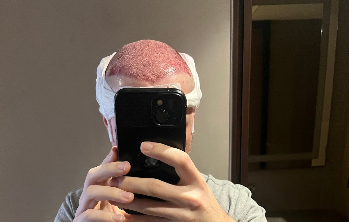 Clinicana Hair Transplant & Esthetic Surgeries — Dr.Visor photo 5