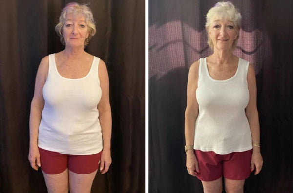 Secret for Weight Loss | Bariatric Surgery | Sioux Falls, SD