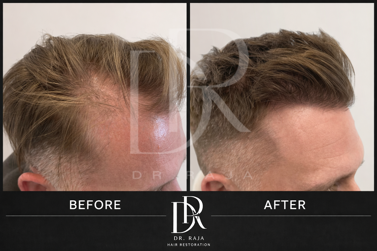 Dr. Raja Hair Restoration — photo 2