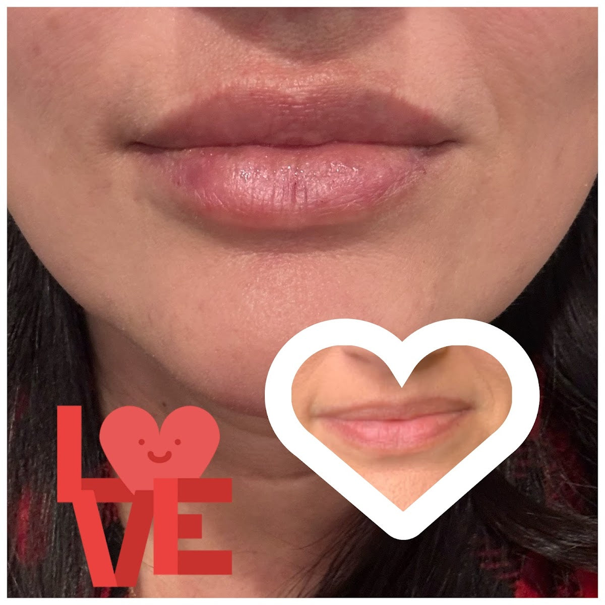 Seymour Beauty Aesthetics | Aesthetic Surgery | Maurice, LA