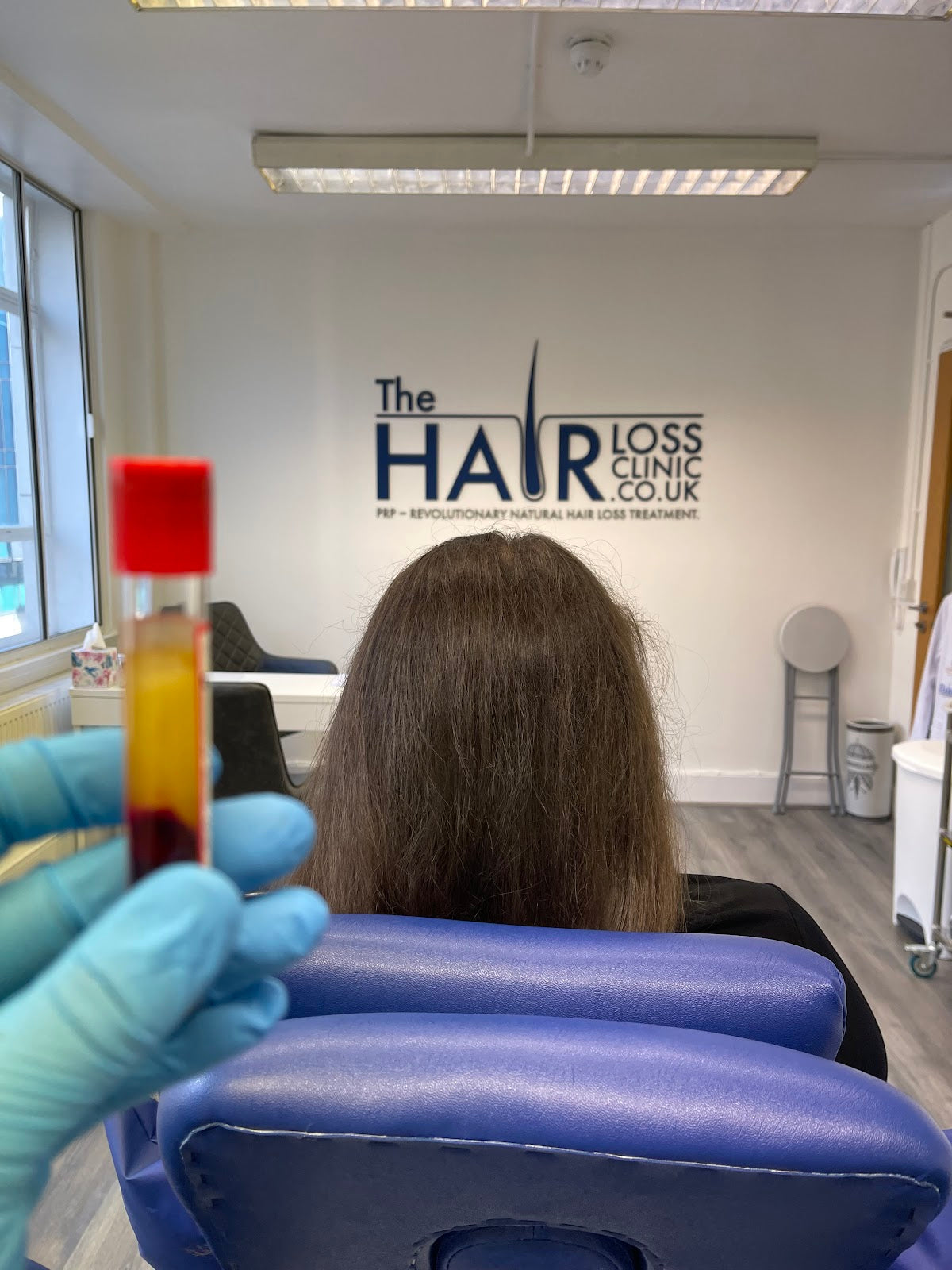 The Hair Loss Clinic | PRP + PRF Injections £195* | Exosomes | Steroid Alopecia Treatment — Hair Transplant Clinic in Manchester