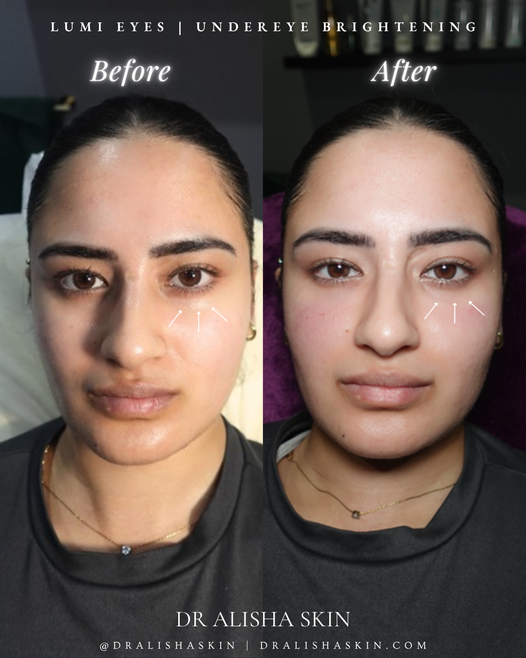 Dr Alisha Skin | Luxe Facials & Aesthetics Clinic | Leeds — photo 5