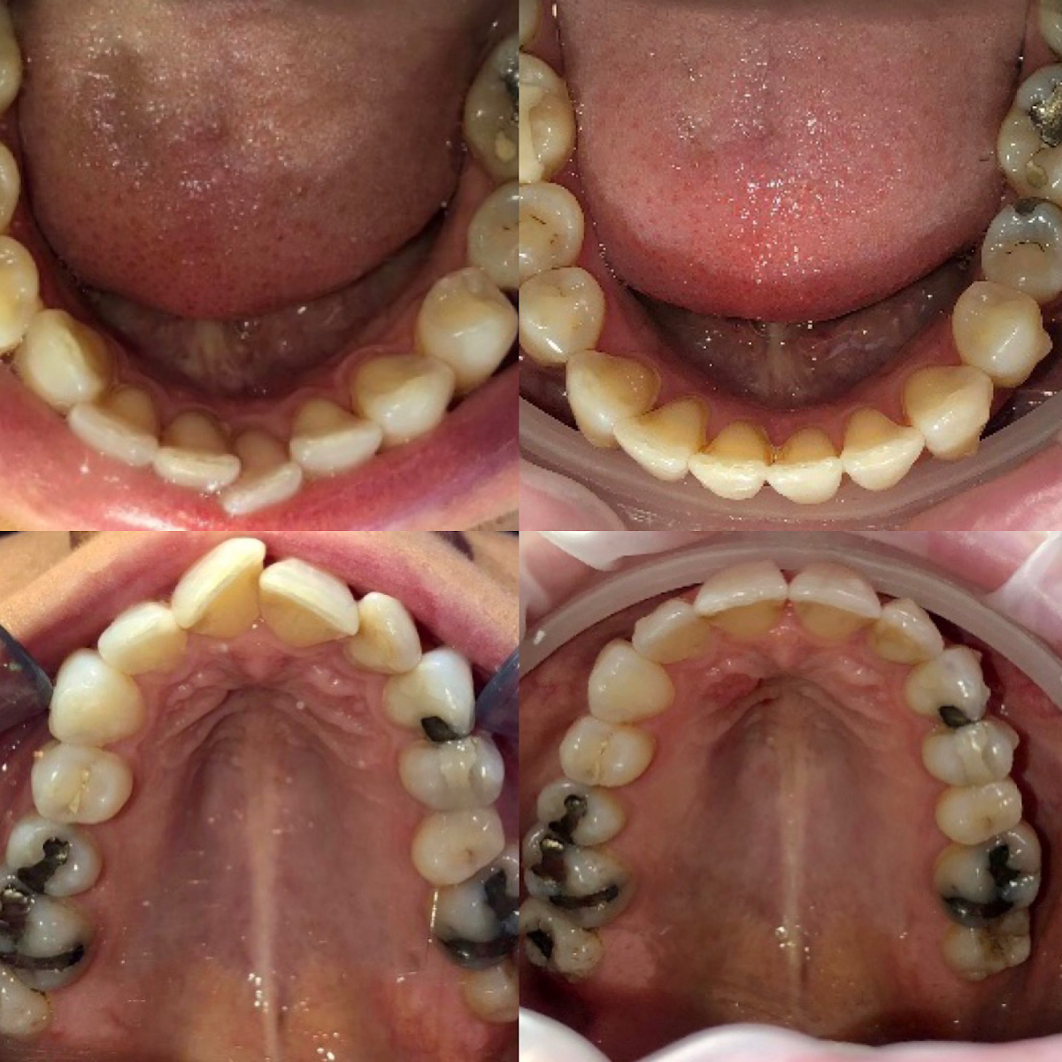The Gentle Dental & Implant Clinic — photo 4