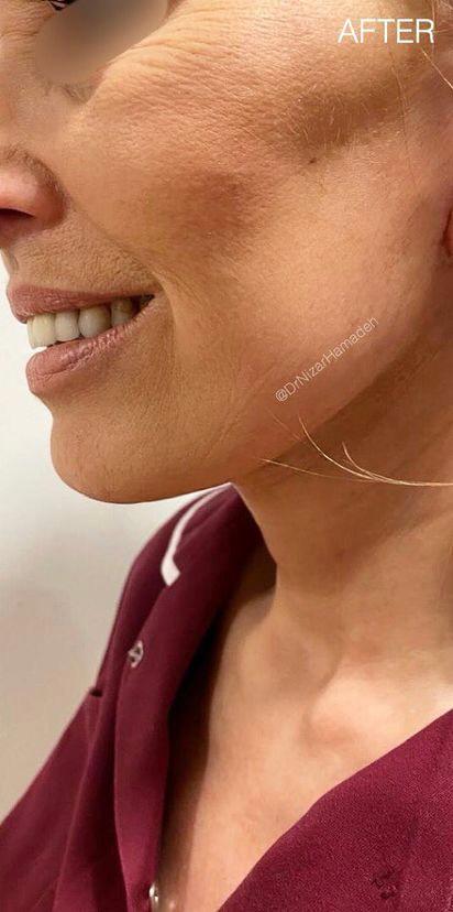Dr Nizar Hamadeh — Aesthetic Surgery Clinic in London