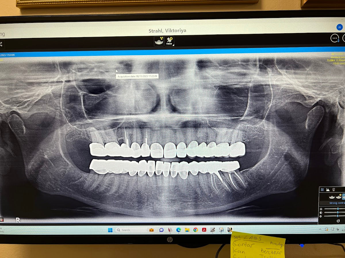 ÖZEL WESTDENT AĞIZ DİŞ HASTANESİ- Türkiye İzmir İmplant Diş Dent Clinic Türkey Dental İmplants in Turkey Zirconium in Turkey — Dr.Visor photo 5