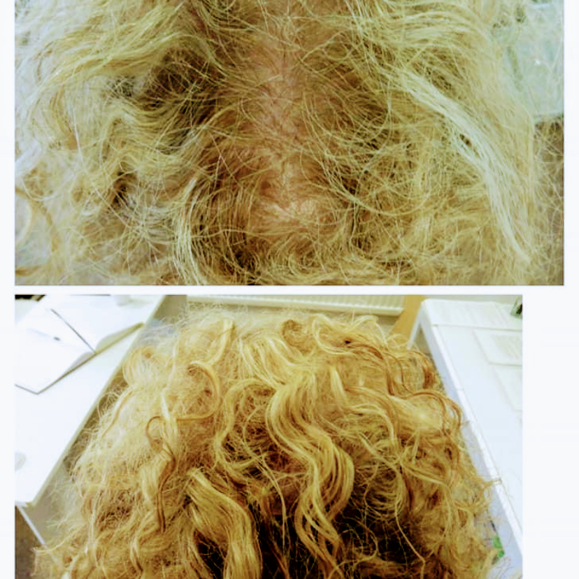Newcastle Hair Loss Clinic — photo 5