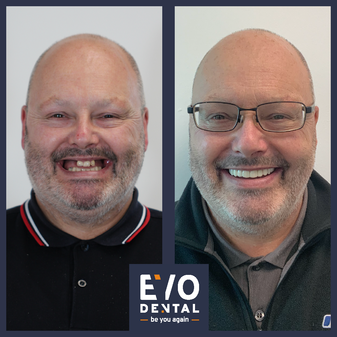 EvoDental — photo 4