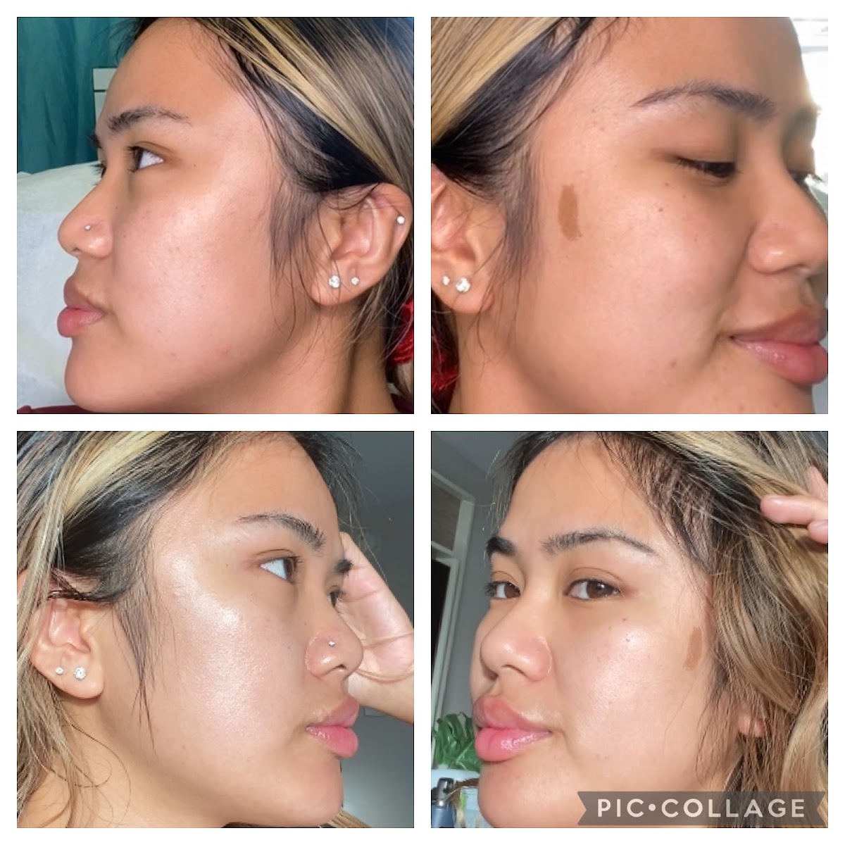 Rejuve Aesthetics & Wellness | Aesthetic Surgery | Waipahu, HI