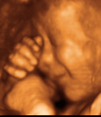 TomorrowToday Ultrasound | IVF | 98-084 Kamehameha Hwy Ste 301A, HI