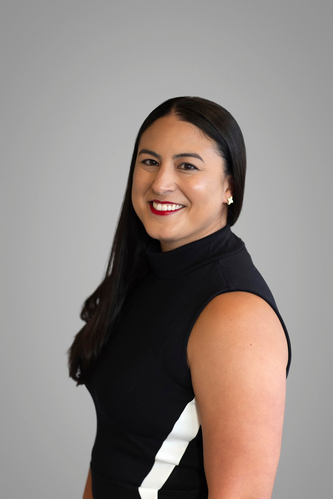 Teresa Gonzaga, MD | Aesthetic Surgery | Green Bay, WI