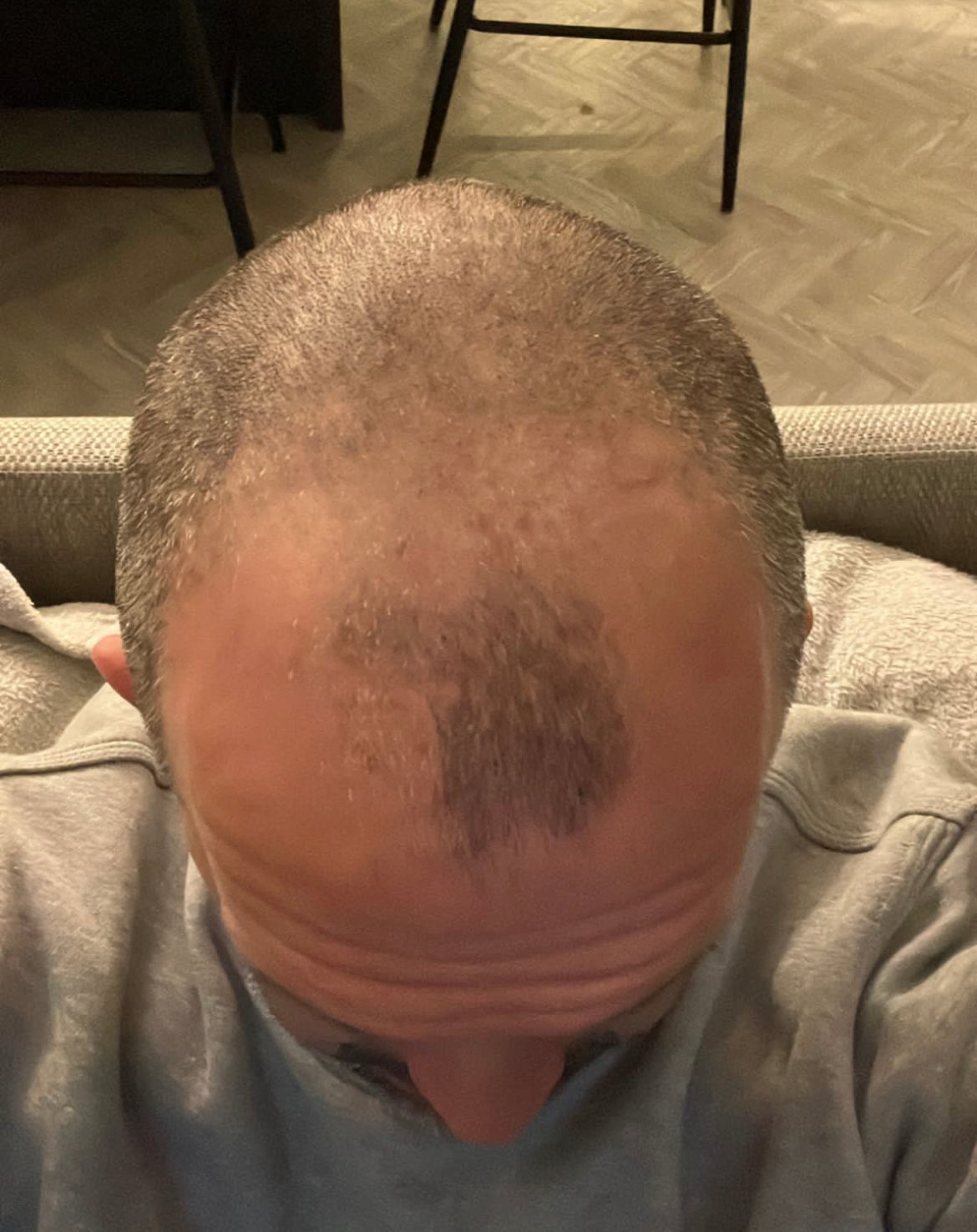 Stoke on Trent Hair Loss Clinic — photo 3
