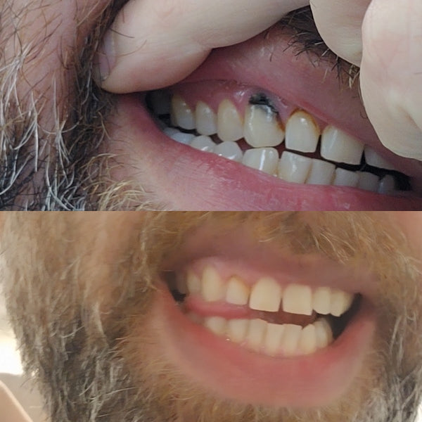 Central Family Dental | Dental | Dover, NH