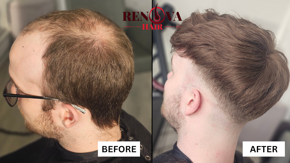 Renova Hair Trichology — photo 4