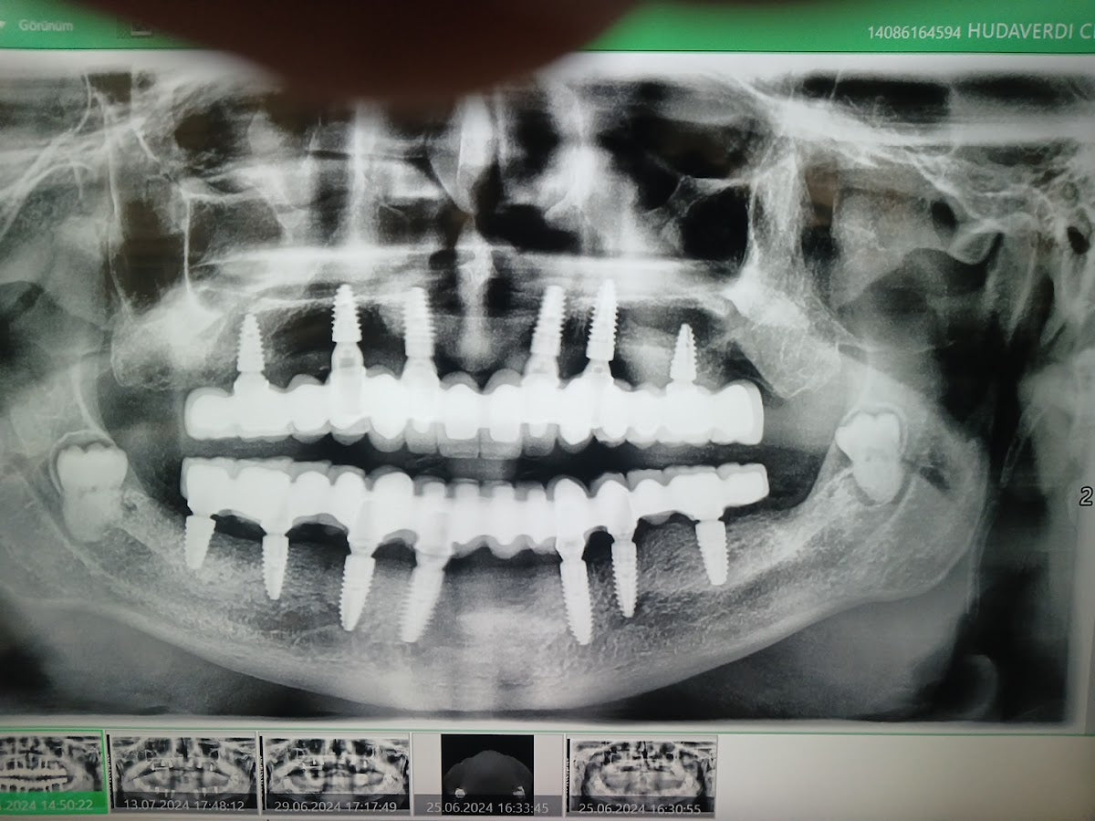Ersoz Agiz ve Dis Sagligi Merkezi — Dr.Visor photo 5