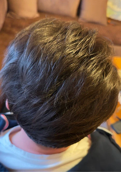 Hairlossandscalpclinic — photo 4