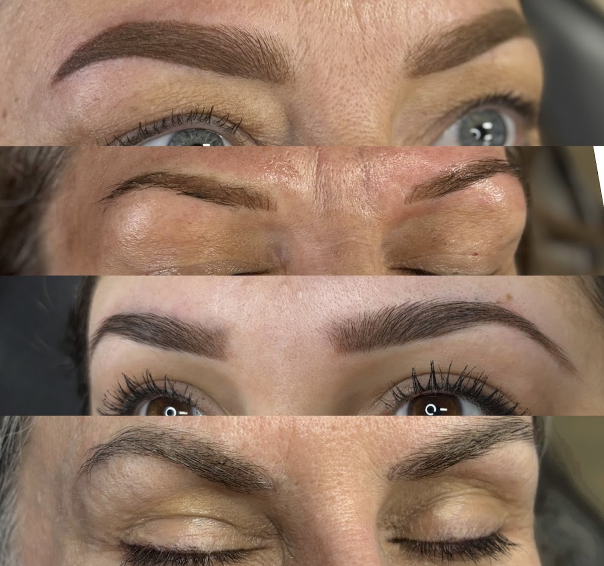 The Art of Transformations LLC | Hair Transplant | Boise, ID