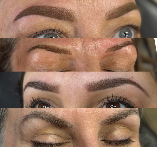 The Art of Transformations LLC | Hair Transplant | Boise, ID