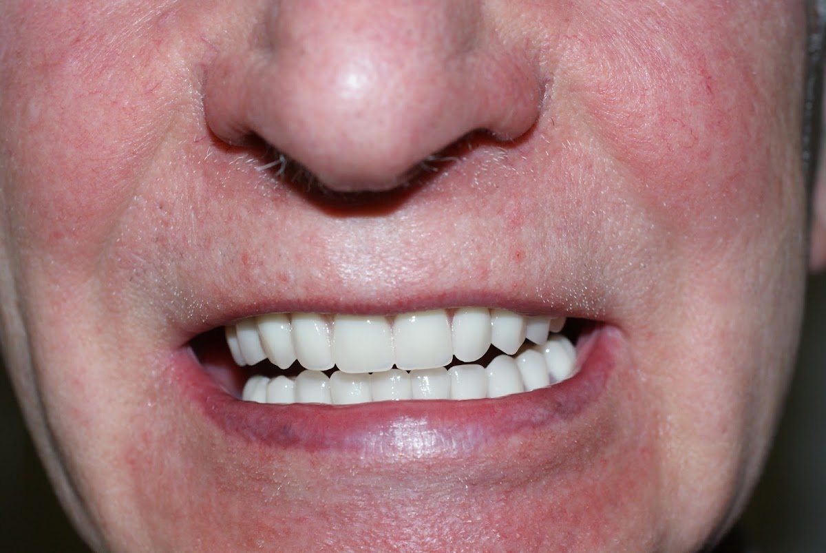 Dental Care Ireland Molesworth — Dr.Visor photo 5