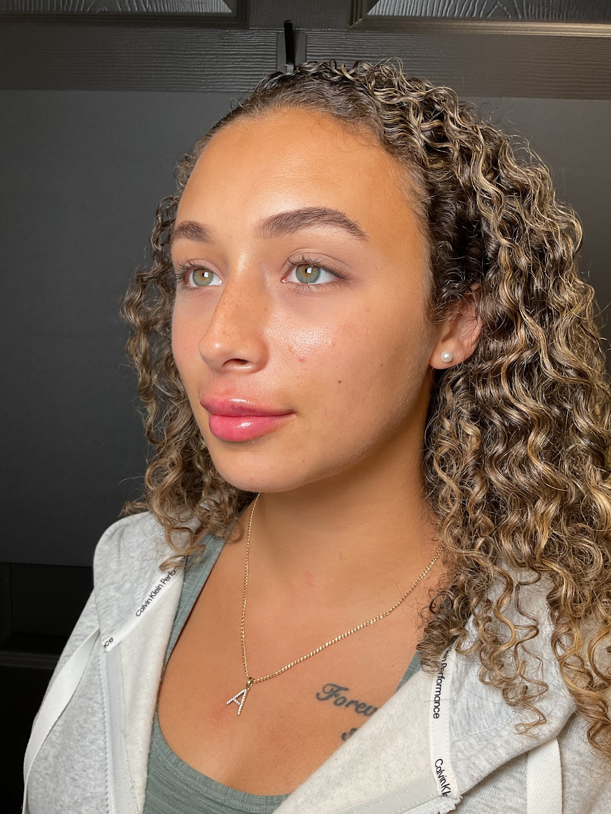 Island Aesthetics | Aesthetic Surgery | 1780 Grand Island Blvd Ste 3, NE