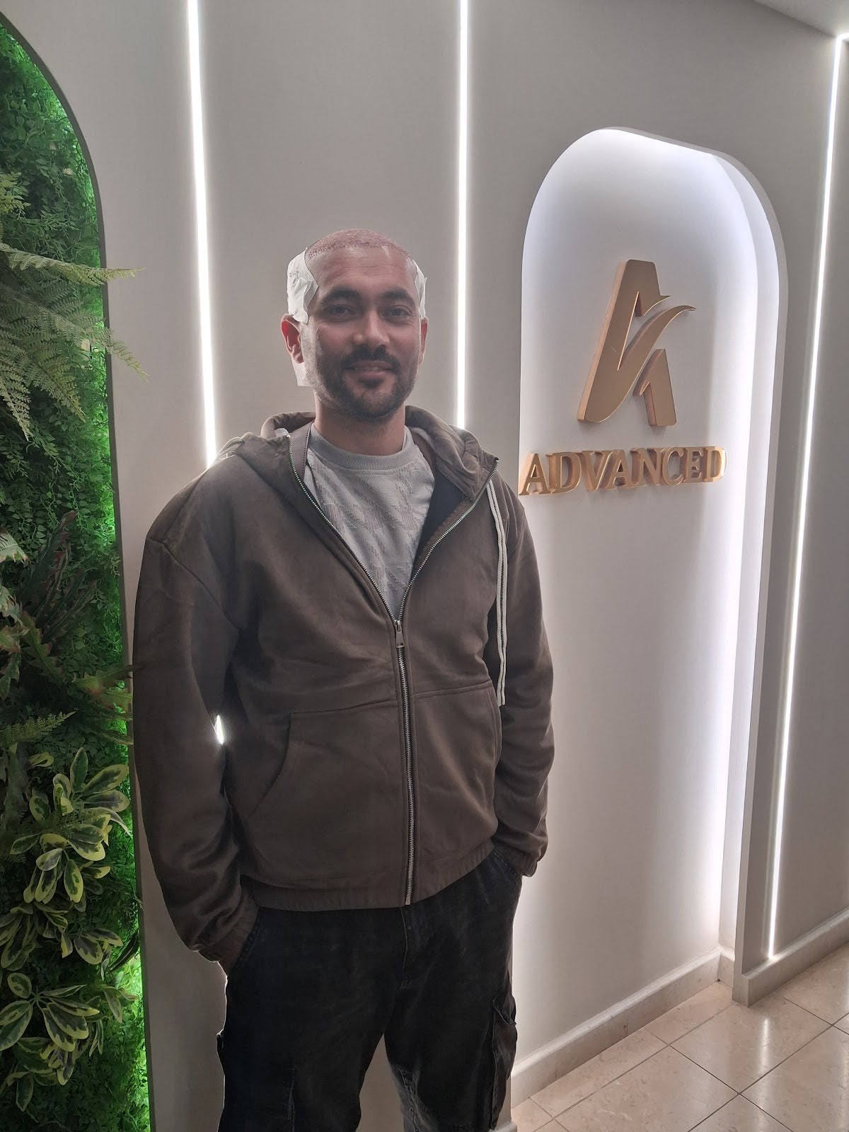 Advanced Hair Transplant Clinic - Hair Transplant clinic in Tiranë, Albania