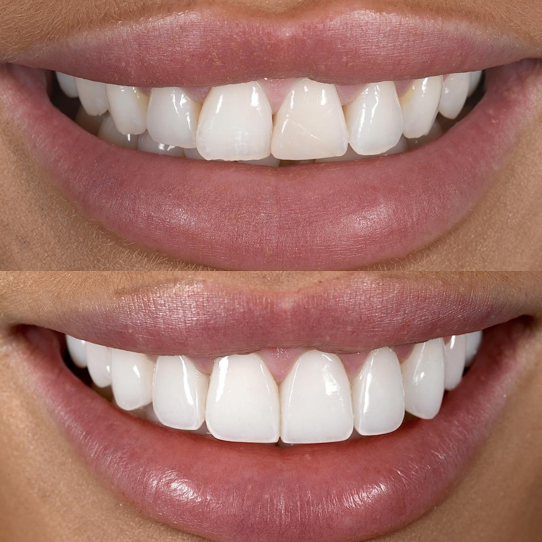 Ringway Dental - Altrincham - Cosmetic and Implant Dentistry — Dental Clinic in Manchester