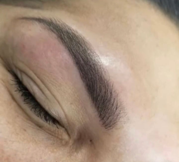 Sapphire Cosmetic | Hair Transplant | Las Cruces, NM