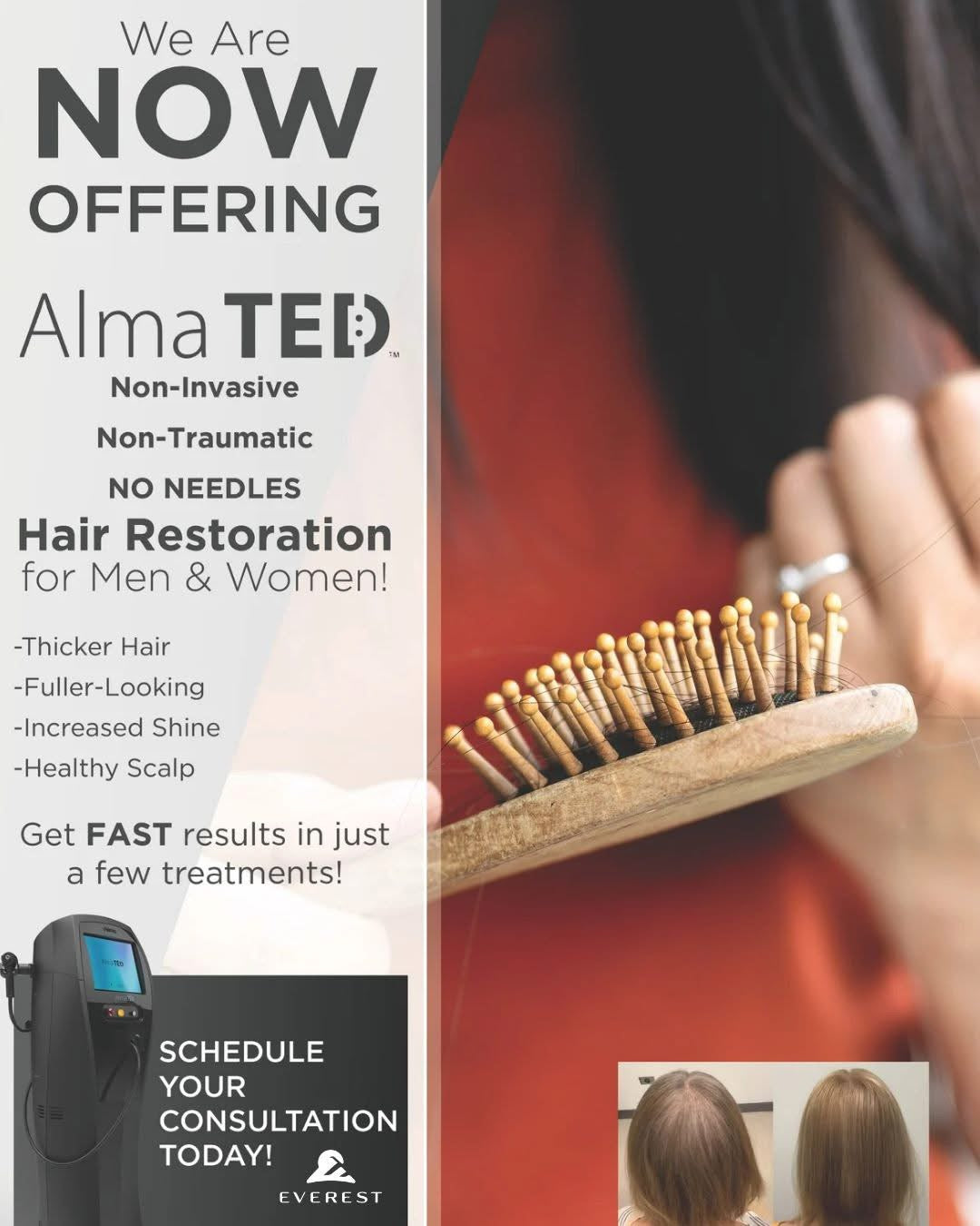 Everest Regenerative Medicine | Hair Transplant | West Fargo, ND