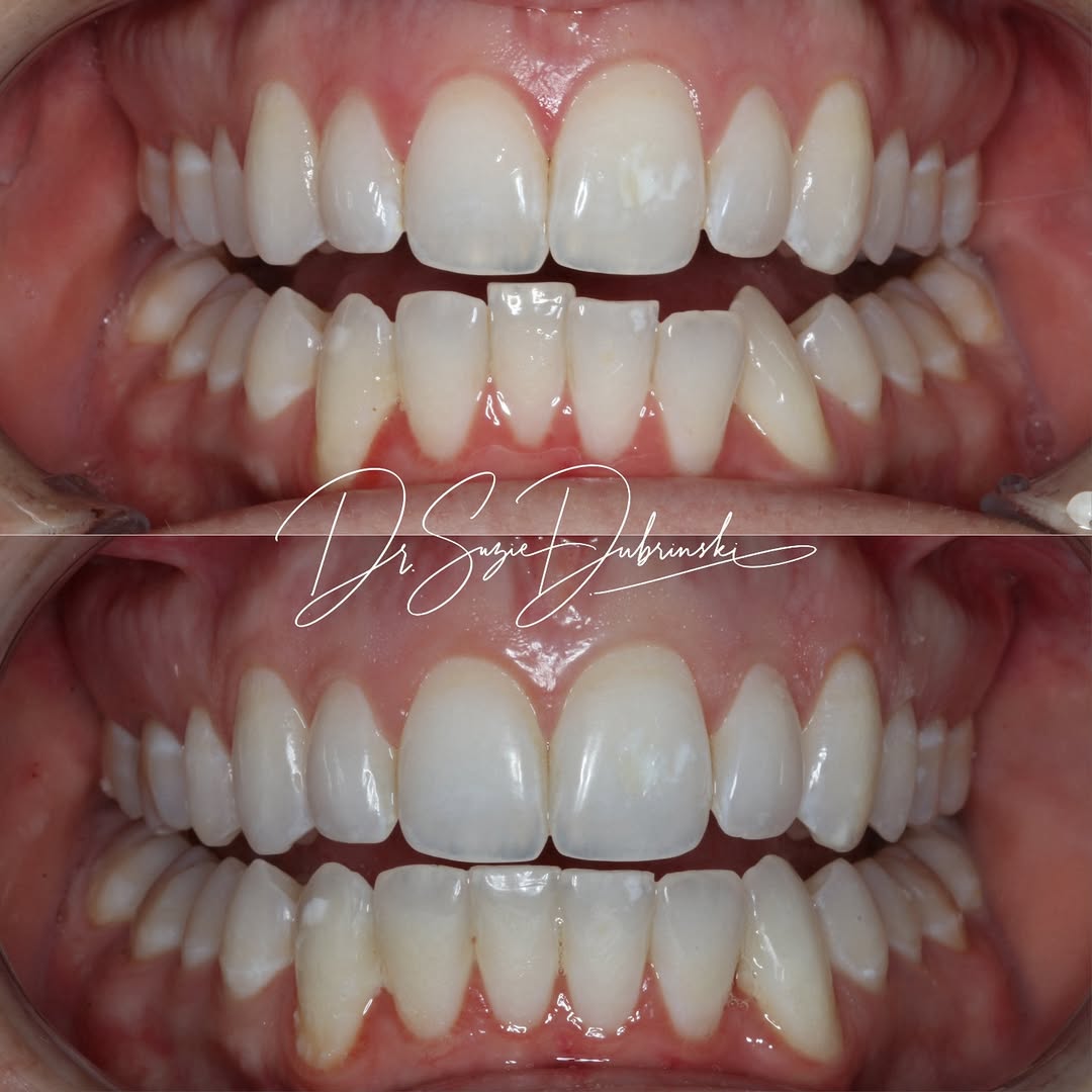 Sculpt Dental Spa | Dental | Charleston, SC