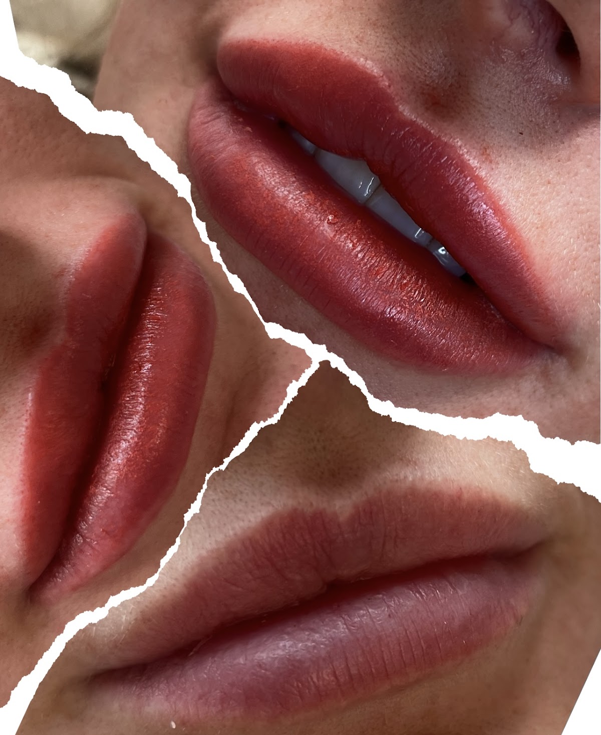 BBL Aesthetic Clinic - Aesthetic Surgery clinic in Glasgow, United Kingdom