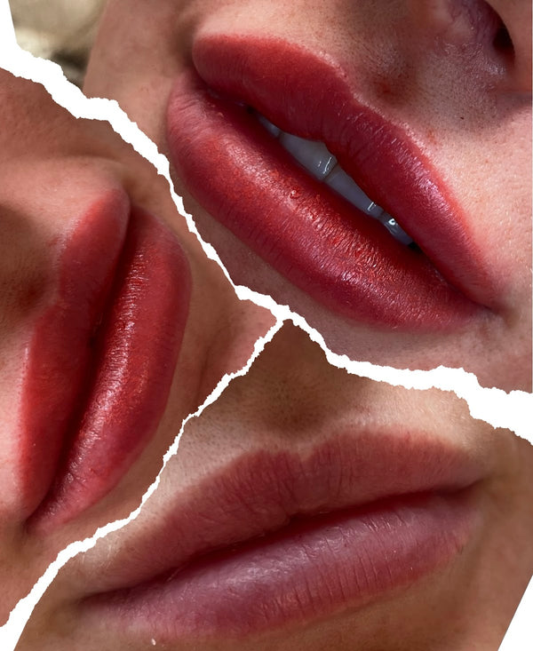 BBL Aesthetic Clinic | Aesthetic Surgery | Glasgow