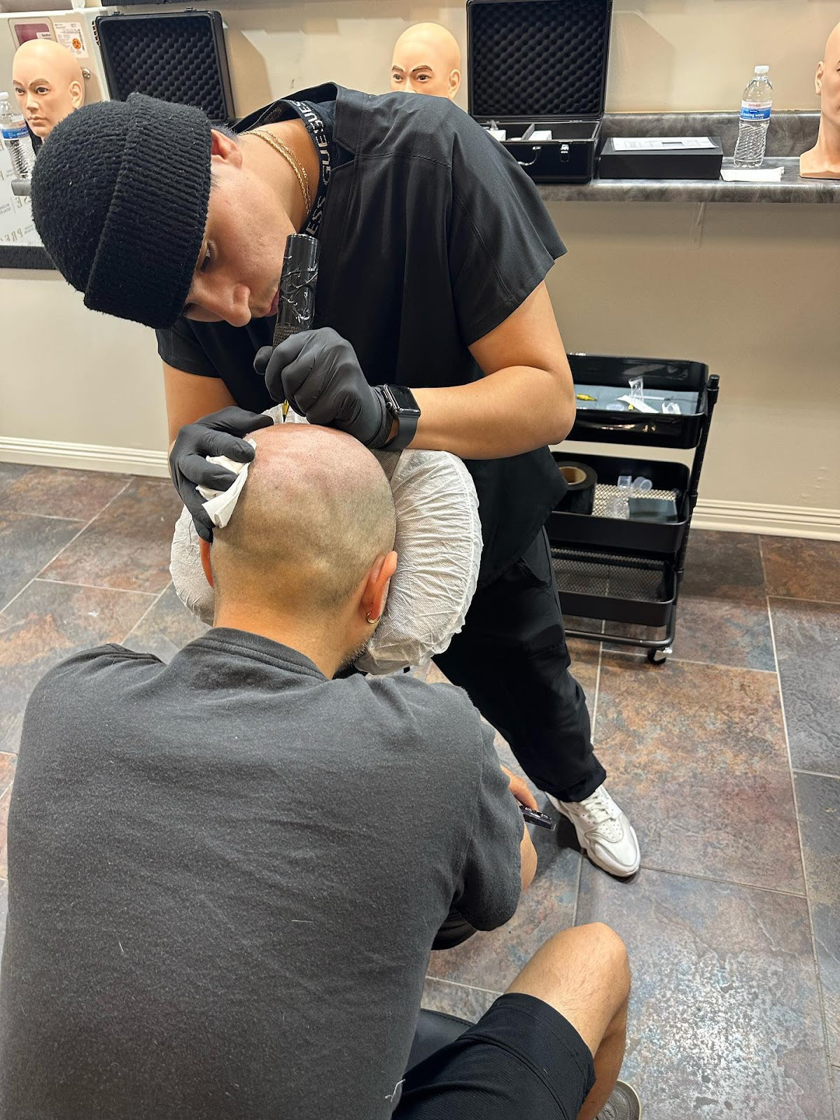 Starstruck SMP | Hair Transplant | Las Vegas, NV
