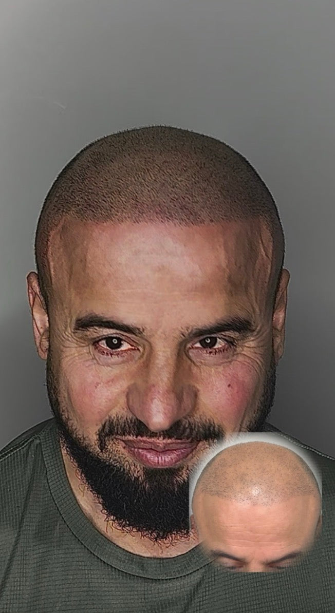 The Hairline Guy — photo 4