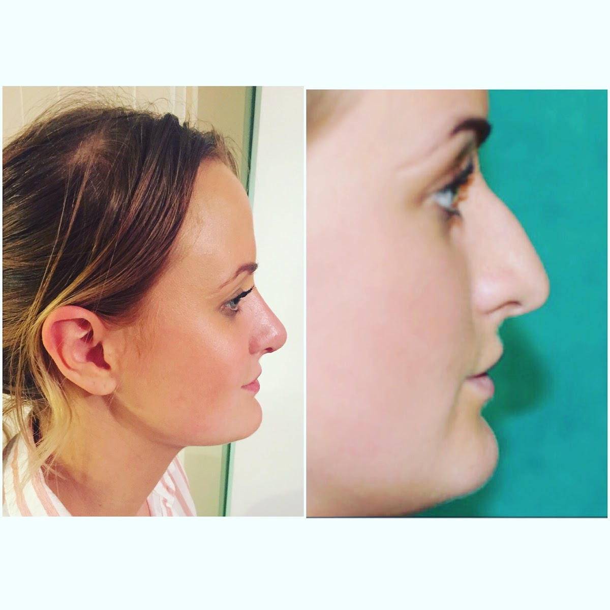 Paul Wilson Aesthetics - Plastic Surgery Bristol - Aesthetic Surgery clinic in Bristol, United Kingdom