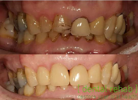 Newcastle Dental Implant Centre | Newcastle Advanced Dentistry — photo 5